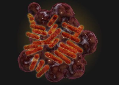 Microscopic Image of Bacteria from Rickettsia Diagnosis