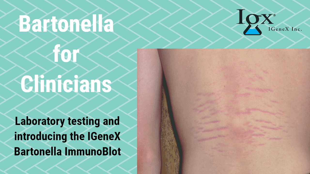 Bartonella ImmunoBlots