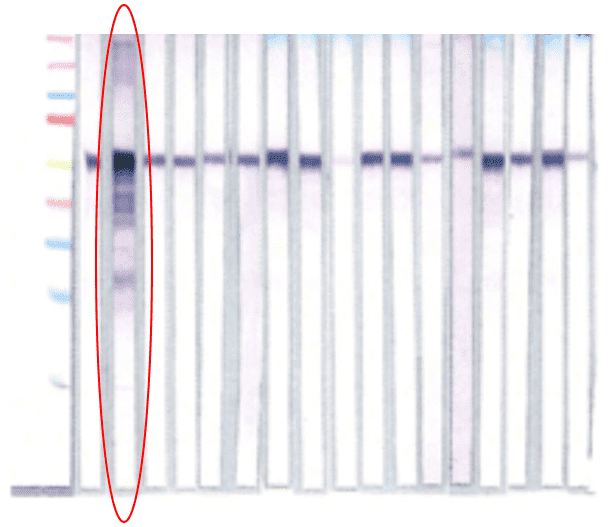 rev-western-blot-img