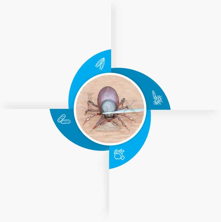 4 Steps to Safely Remove A Tick from Skin